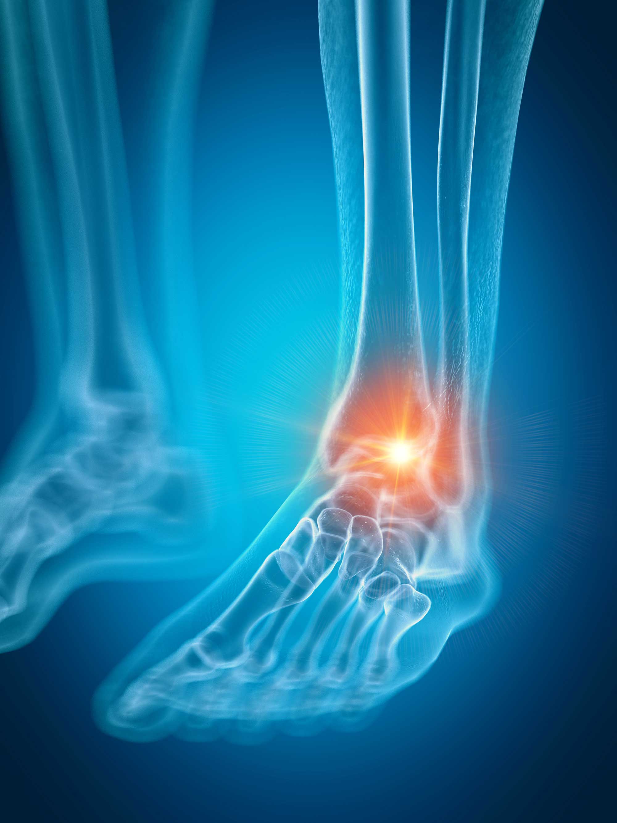 Ankle pain illustration