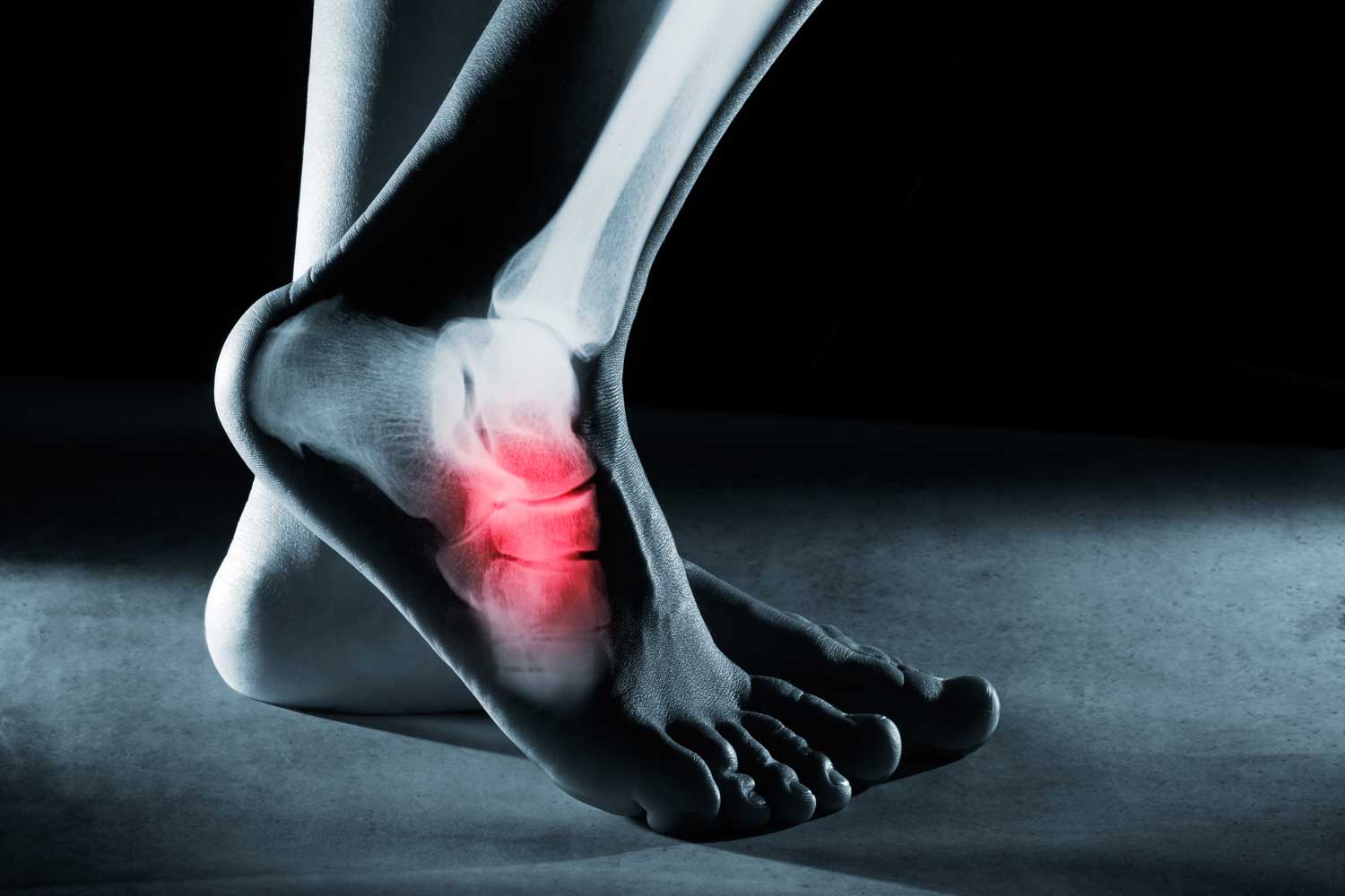 Foot and ankle X-ray