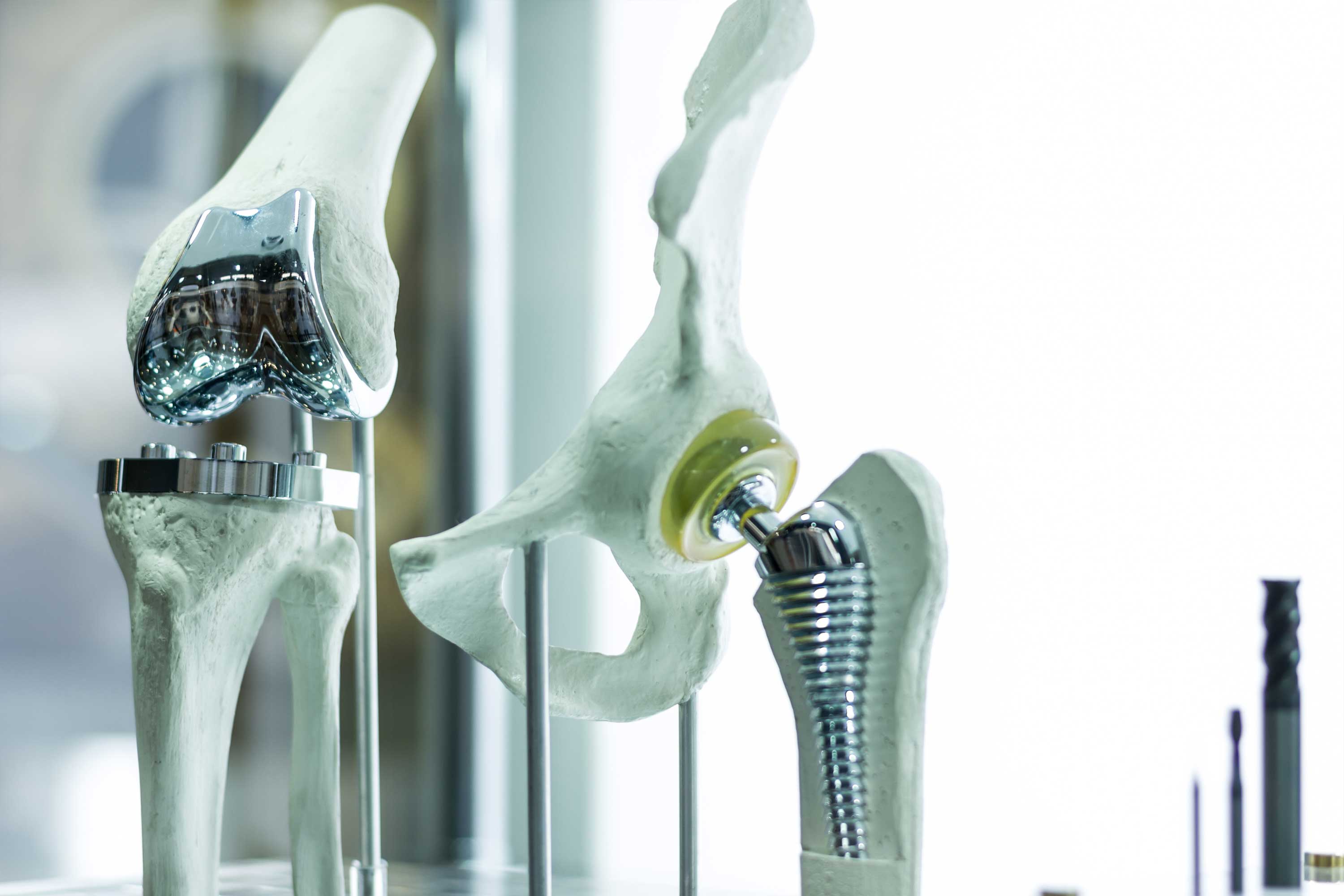 Joint replacement models
