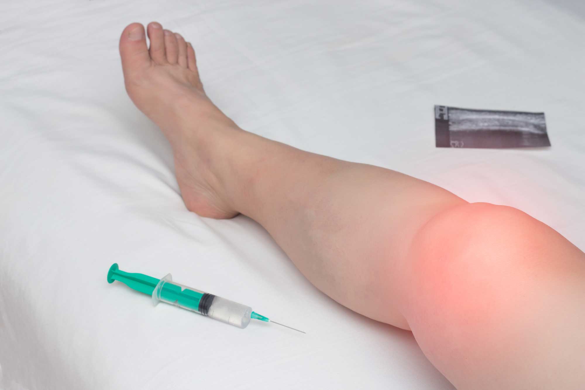 Patient receiving a joint injection