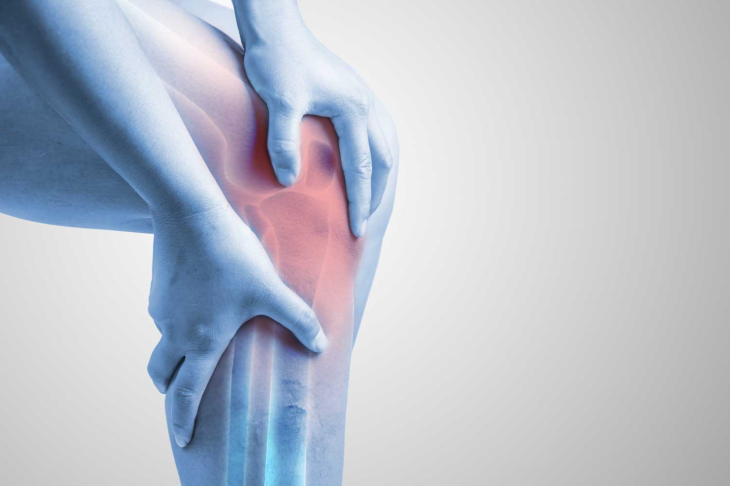 Meniscus tear illustration